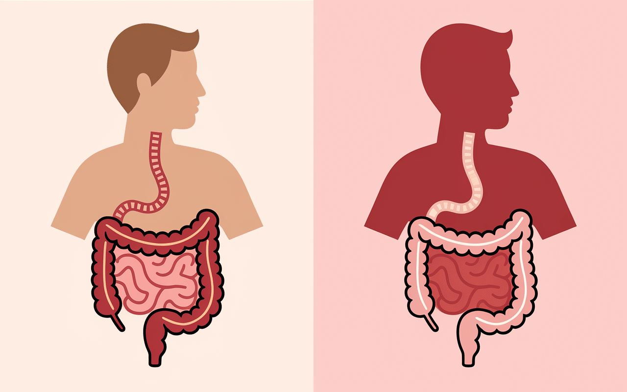 Schéma intestin bouché vs normal